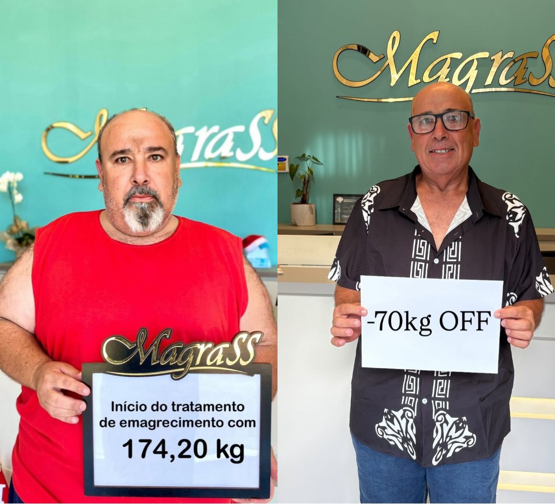 Antes e depois 3